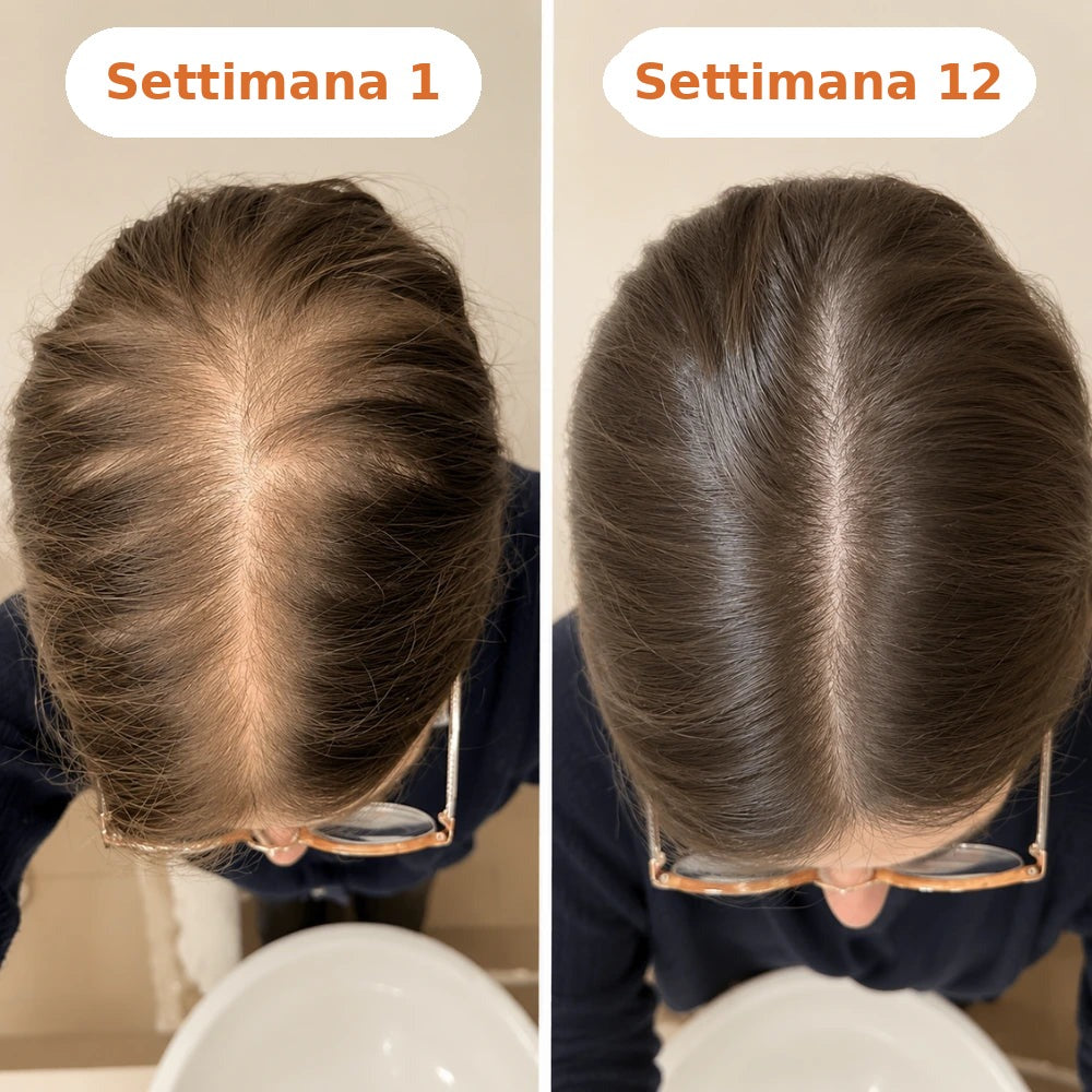 Settimana 1 vs 12