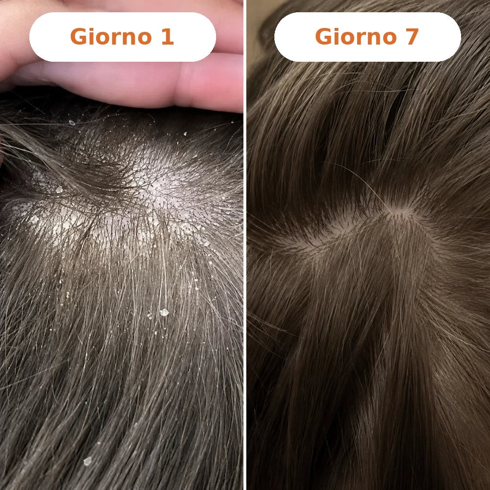 Giorno 1 vs 7