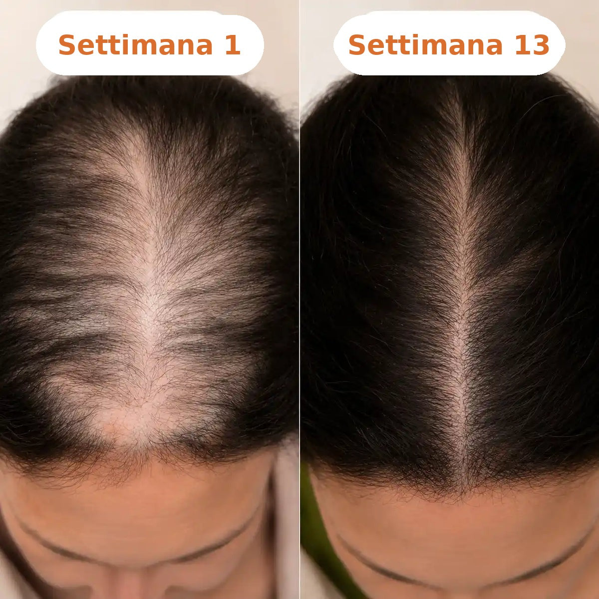 Settimana 1 vs 13