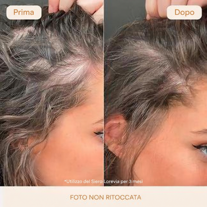 Siero Crescita Capillare Lorevia