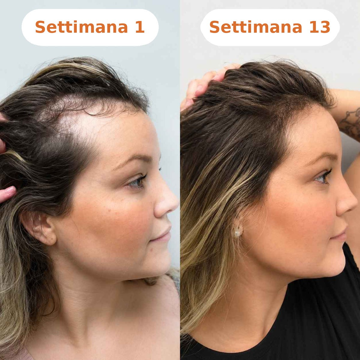 Settimana 1 vs 13 profilo